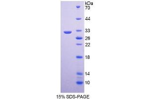 SDS-PAGE analysis of Human COL4a5 Protein. (COL4a5 Protein)