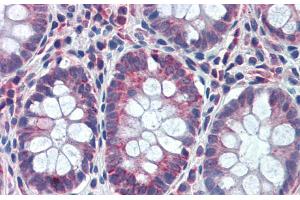 Rabbit Anti-GATA6 Antibody Catalog Number: ARP31859 Paraffin Embedded Tissue: Human Colon Antibody Concentration: 5 ug/ml (GATA6 antibody  (Middle Region))