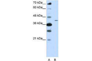 WB Suggested Anti-ZNF488 Antibody Titration:  0.