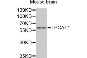Western Blotting (WB) image for anti-Lysophosphatidylcholine Acyltransferase 1 (LPCAT1) antibody (ABIN1876240) (LPCAT1 antibody)