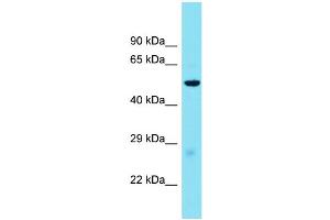 Host: Rabbit  Target Name: Glp1r  Sample Tissue: Mouse Liver lysates  Antibody Dilution: 1. (GLP1R antibody  (Middle Region))
