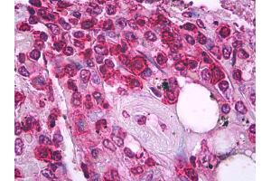 Anti-CD45RO antibody IHC of human spleen, t lymphocytes. (CD45RO antibody)