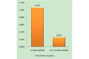 Immunohistochemistry analysis of paraffin-embedded human brain tissue using Ephrin B1/B2 (Phospho-Tyr329) antibody. (Ephrin B1/B2 (pTyr329) antibody)