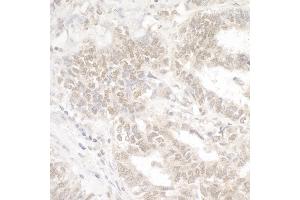 anti-Ankyrin Repeat-Containing Protein (EHMT2) (C-Term) antibody