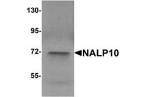 Western blot analysis of NALP10 in human brain tissue lysate with NALP10 antibody at 1 μg/ml. (NLRP10 antibody  (N-Term))