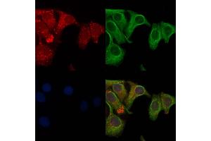ABIN6261041 and ABIN6272826 staining Hela cells by IF/ICC. (CRMP1 antibody  (C-Term))