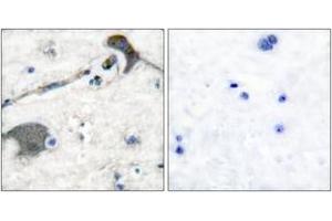 Immunohistochemistry analysis of paraffin-embedded human brain tissue, using RASH/RASK Antibody. (RASH/RASK (AA 1-50) antibody)