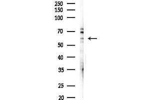 anti-Wntless Homolog (WLS) (C-Term) antibody