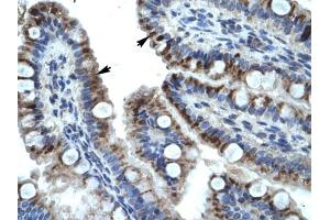 Immunohistochemical staining (Formalin-fixed paraffin-embedded sections) of human intestine with KRT15 polyclonal antibody . (KRT15 antibody  (AA 407-456))