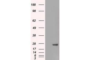 Western Blotting (WB) image for anti-Adenylate Kinase 1 (AK1) antibody (ABIN1496517) (Adenylate Kinase 1 antibody)