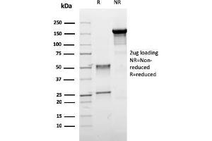 SDS-PAGE Analysis Purified ER-beta Mouse Monoclonal Antibody (ESR2/3005). (ESR2 antibody)