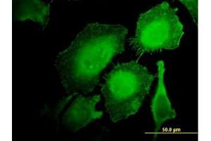 Image no. 2 for anti-Hematopoietic Cell-Specific Lyn Substrate 1 (HCLS1) (AA 266-356) antibody (ABIN598726) (HCLS1 antibody  (AA 266-356))