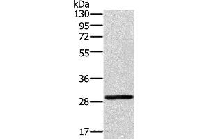 Western blot analysis of 293T cell, using EDA2R Polyclonal Antibody at dilution of 1:450 (Ectodysplasin A2 Receptor antibody)