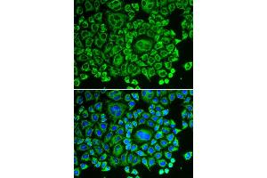 Immunofluorescence analysis of HeLa cell using ARHGDIA antibody. (ARHGDIA antibody)