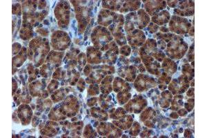 Image no. 1 for anti-Metalloproteinase Inhibitor 2 (TIMP2) antibody (ABIN1501393) (TIMP2 antibody)