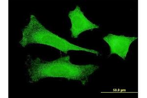 Immunofluorescence of monoclonal antibody to FBXO4 on HeLa cell. (FBXO4 antibody  (AA 1-387))