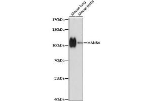 Western blot analysis of extracts of various cell lines, using MANBA antibody (ABIN6291681) at 1:1000 dilution.