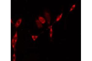 ABIN6275583 staining Hela by IF/ICC. (NHE8 antibody  (C-Term))