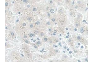 DAB staining on IHC-P; Samples: Human Liver Tissue (PDE1A antibody  (AA 2-318))