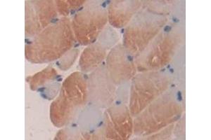 Figure. (ALOX5 antibody  (AA 374-536))