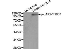 Western Blotting (WB) image for anti-Janus Kinase 2 (JAK2) (pTyr1007) antibody (ABIN3020271) (JAK2 antibody  (pTyr1007))