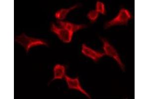 ABIN6276149 staining HeLa by IF/ICC. (OR4C6 antibody  (Internal Region))