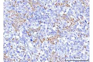 IHC analysis of PTPIP51/RMDN3 using anti-PTPIP51/RMDN3 antibody (ABIN7601775). (RMDN3 antibody  (AA 45-438))