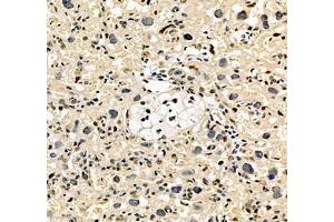 Immunohistochemistry of paraffin embedded rat placenta using notch3 (ABIN7074862) at dilution of 1:700 (250x lens)