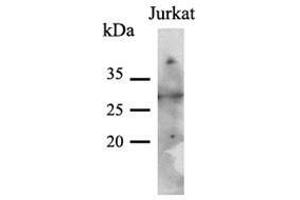 The cell lysates (40 ug) were resolved by SDS-PAGE, transferred to PVDF membrane and probed with anti-human PNMT antibody (1:500). (PNMT antibody  (AA 1-282))