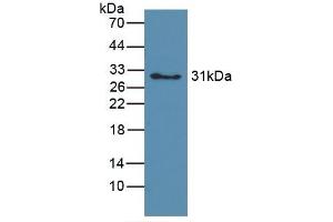 Detection of Recombinant hemoglobin, Canine using Polyclonal Antibody to Hemoglobin (HB) (Hemoglobin antibody)