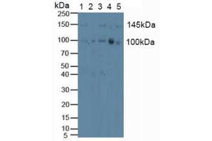 Figure. (PKC mu antibody  (AA 651-876))