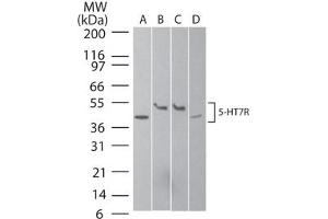Serotonin Receptor 7 Western Blot.