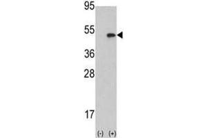 Western blot analysis of Aurora B antibody and 293 cell lysate (2 ug/lane) either nontransfected (Lane 1) or transiently transfected with the AURKB gene (2). (Aurora Kinase B antibody  (AA 6-35))