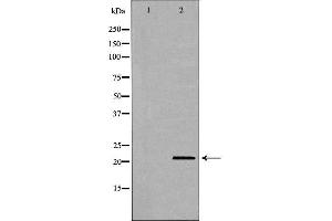 anti-CD70 Molecule (CD70) (Internal Region) antibody