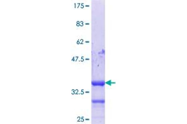 HIC1 Protein (AA 627-705) (GST tag)