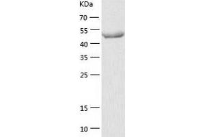 Western Blotting (WB) image for GDP Dissociation Inhibitor 1 (GDI1) (AA 1-447) protein (His tag) (ABIN7285942) (GDI1 Protein (AA 1-447) (His tag))