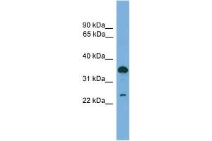 WB Suggested Anti-TPD52 Antibody Titration:  0. (TPD52 antibody  (C-Term))