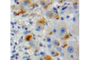 IHC-P analysis of Liver tissue, with DAB staining. (DCL1 antibody  (AA 23-232))