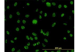 Immunofluorescence of monoclonal antibody to MLH1 on HeLa cell. (MLH1 antibody  (AA 1-756))