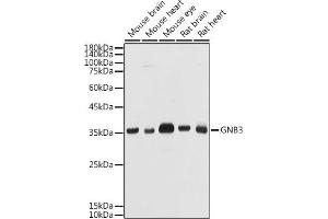Western blot analysis of extracts of various cell lines, using GNB3 antibody (ABIN1680055, ABIN3015467, ABIN3015468 and ABIN6218020) at 1:1000 dilution. (GNB3 antibody  (AA 1-230))