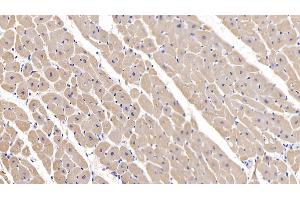 Detection of MYH2 in Human Cardiac Muscle Tissue using Polyclonal Antibody to Myosin Heavy Chain 2 (MYH2) (MYH2 antibody  (AA 1237-1471))
