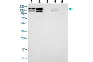 Western blot analysis of Lane 1: RT-4, Lane 2: U-251 MG, Lane 3: Human Plasma, Lane 4: Liver, Lane 5: Tonsil with CCAR1 polyclonal antibody .
