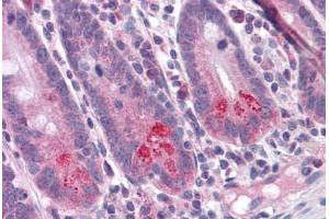 Human Small Intestine: Formalin-Fixed, Paraffin-Embedded (FFPE) (BIRC6 antibody  (C-Term))