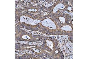 IHC analysis of HSD17B7 using anti-HSD17B7 antibody (ABIN7600174). (HSD17B7 antibody  (AA 16-336))