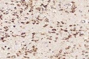 Immunohistochemistry analysis of paraffin-embedded mouse brain using,RPL10 (ABIN7075428) at dilution of 1: 4000 (RPL10 antibody)