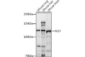 Western blot analysis of extracts of various cell lines, using ACLY antibody (ABIN7265716) at 1:1000 dilution. (ACLY antibody  (AA 752-1101))