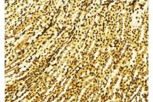 ABIN6269316 at 1/100 staining Human gastric tissue by IHC-P. (MEK1 antibody  (Internal Region))