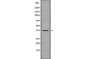 anti-Type 2 Taste Receptor Member 47 (TAS2R30) antibody