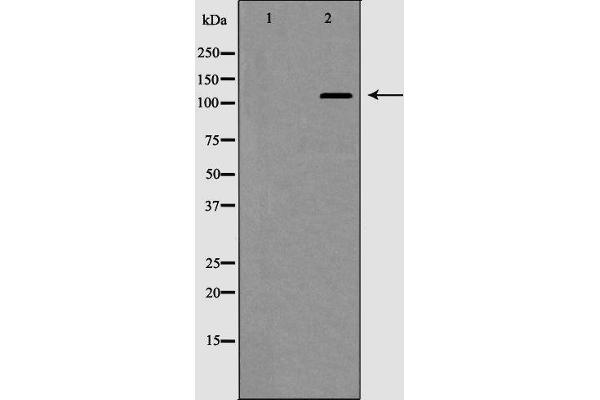 HDAC5 antibody  (C-Term)