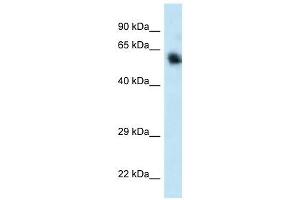 Western Blot showing CAMKK1 antibody used at a concentration of 1. (CAMKK1 antibody  (C-Term))